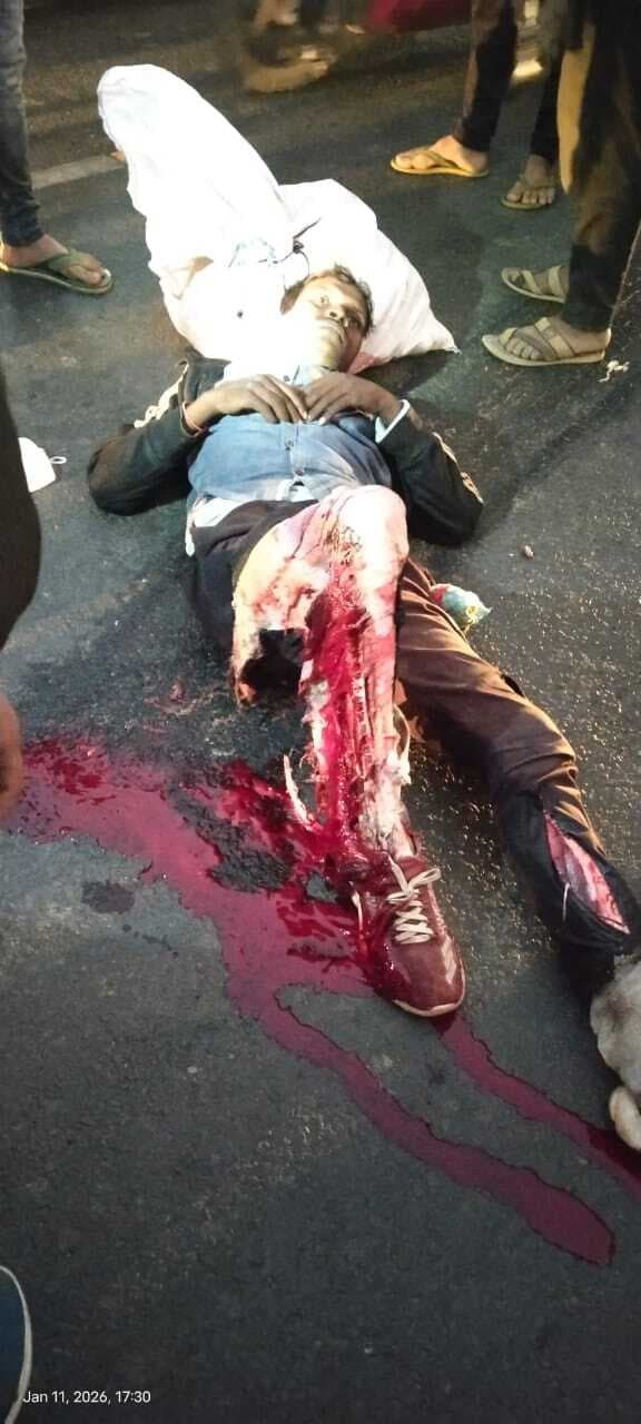 हादसा : कंटेनर के धक्के से साइकिल सवार युवक घायल, रेफर