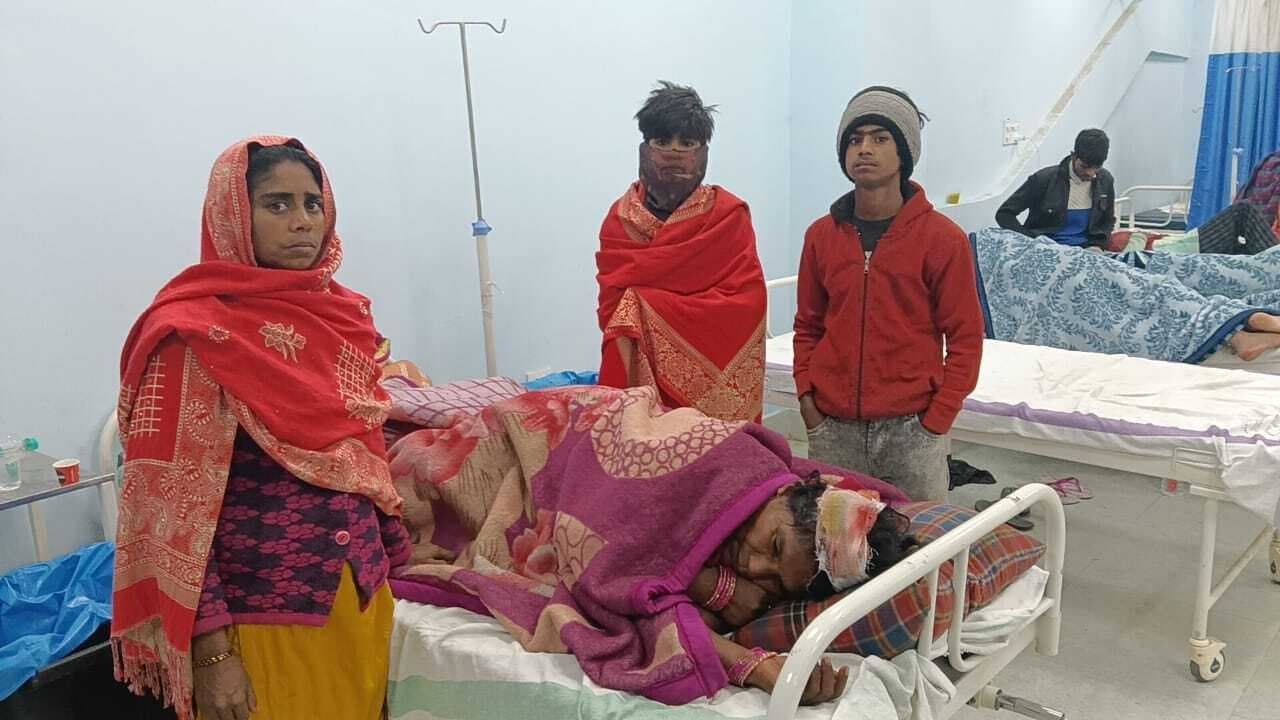बैकुंठपुर में बच्चों के विवाद में मारपीट, महिला घायल