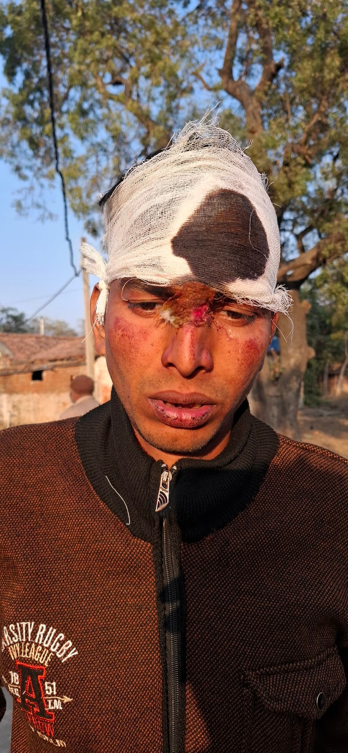 Giridih News :मारपीट में युवक और महिला घायल