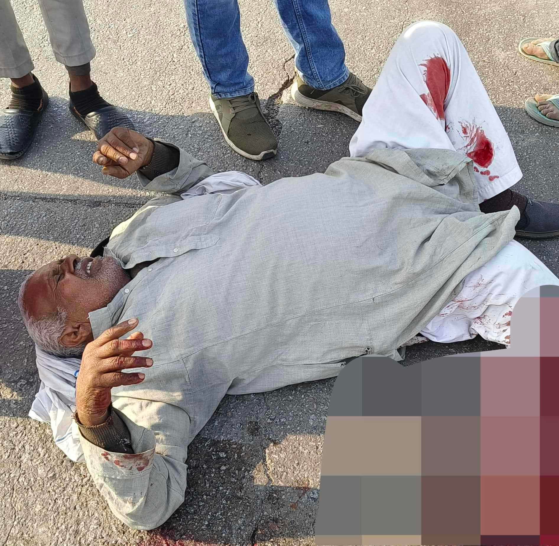 अज्ञात वाहन की टक्कर से   बुजुर्ग का कटा  पैर, हालत गंभीर