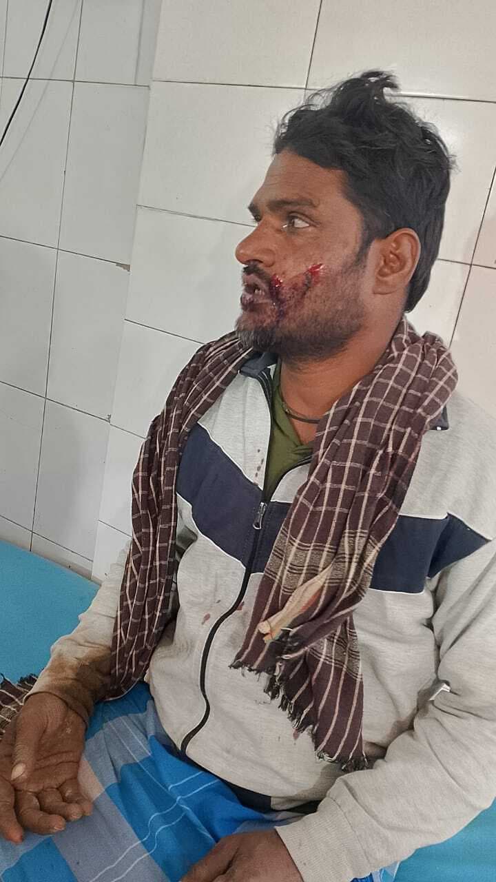 गंगिया में भूमि विवाद को लेकर मारपीट, बच्ची सहित चार लोग जख्मी