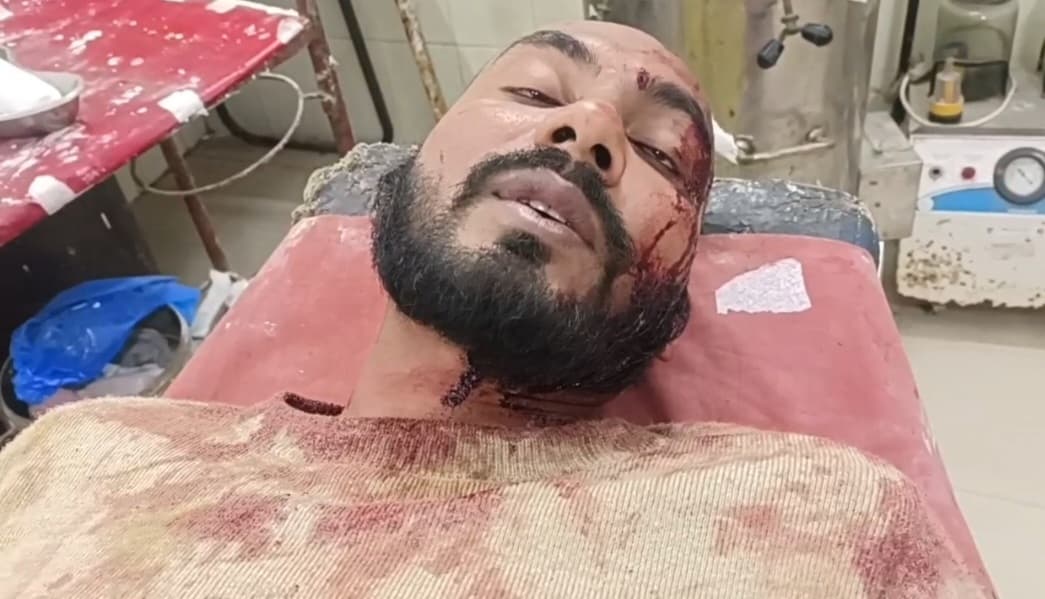 Samastipur News:सीटीई के प्रभारी प्राचार्य व कंसल्टेंट के बीच मारपीट