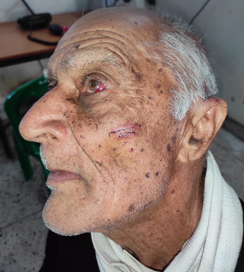 सेवानिवृत्त पंचायत सचिव पर जानलेवा हमला, थाना में आवेदन