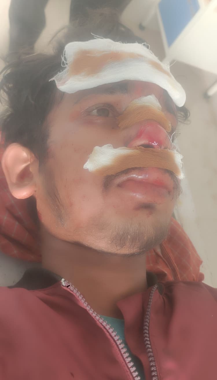 Giridih News :लिफ्ट लेकर बाइक से जा रहा युवक जख्मी