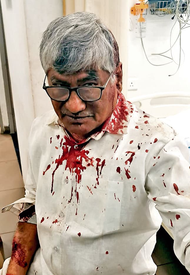 Bokaro News : कोयला चोरों के हमले में अधिकारी घायल