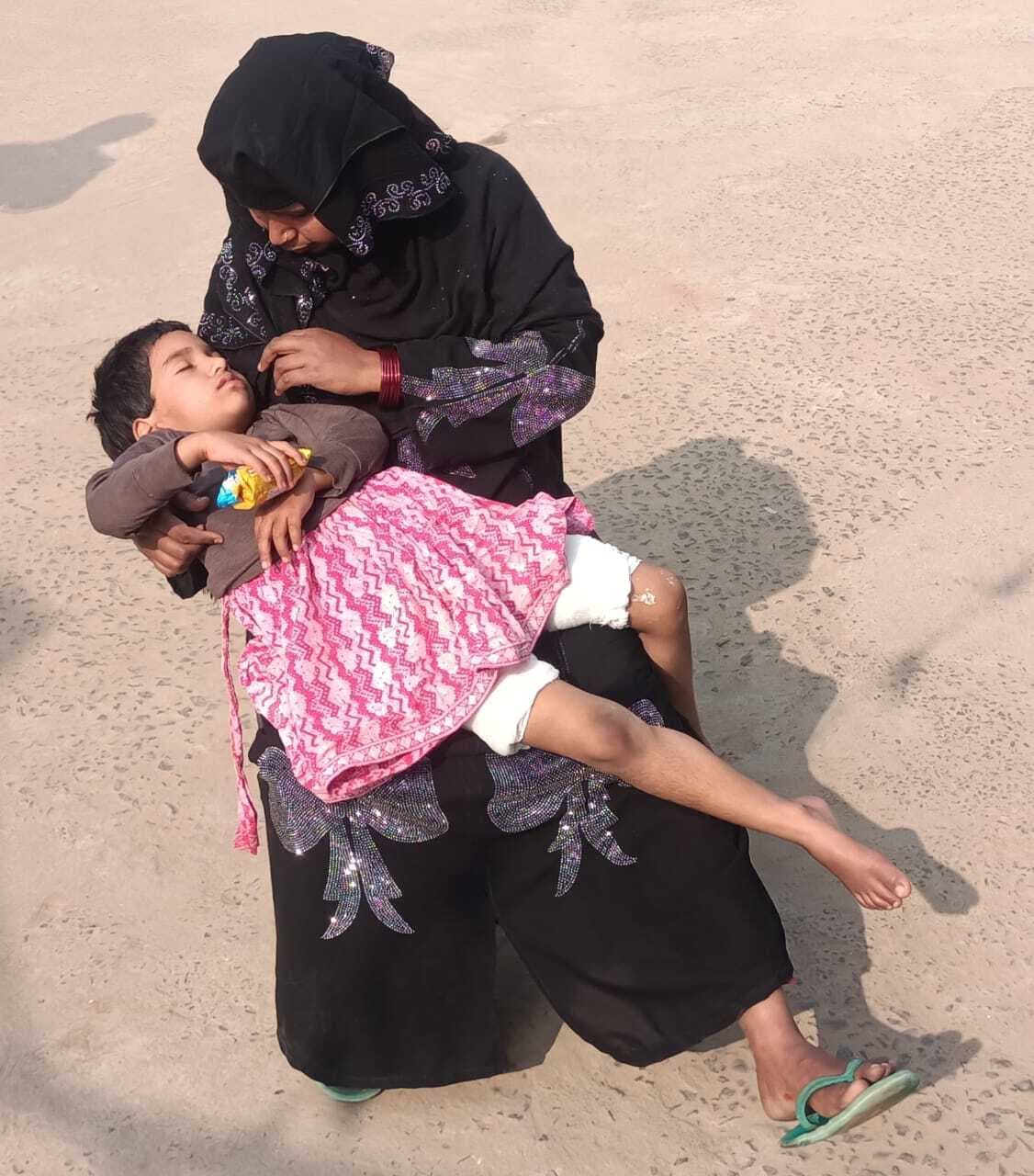 अलाव तापने के दौरान आग से झुलसी बच्ची, रेफर