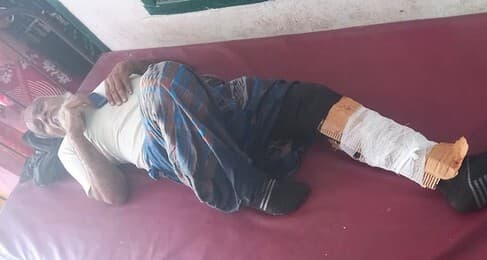 पथरगामा में अलग-अलग सड़क दुर्घटनाओं में चार लोग घायल