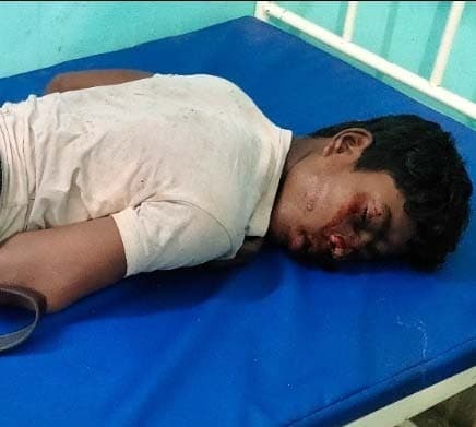 वाहन से टक्कर में एक ही बाइक पर सवार तीन युवक घायल, एक रेफर