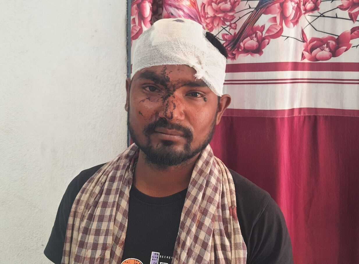 बिजली तार में टोंका लगाकर मछली मारने के विवाद में हुई मारपीट