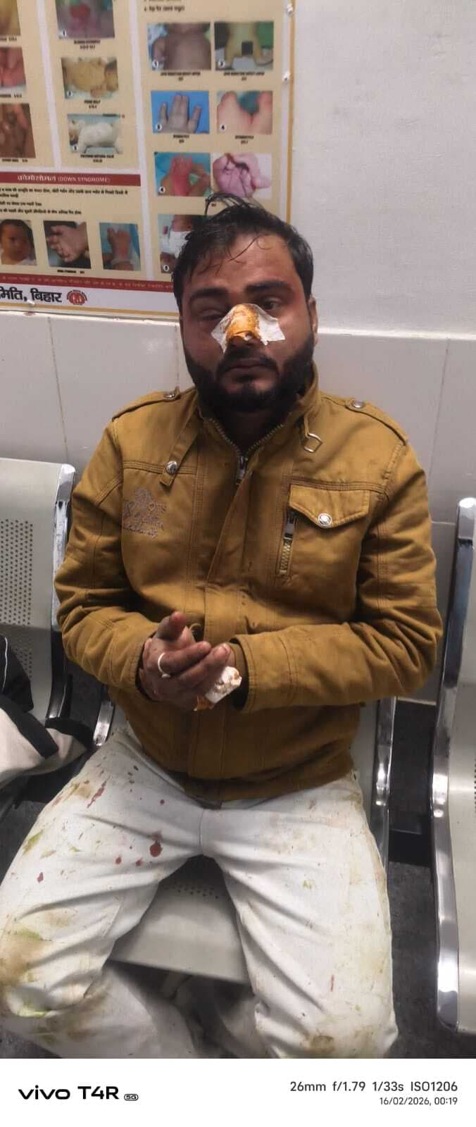 कुर्मा गांव के शिव बारात में मारपीट, युवक जख्मी