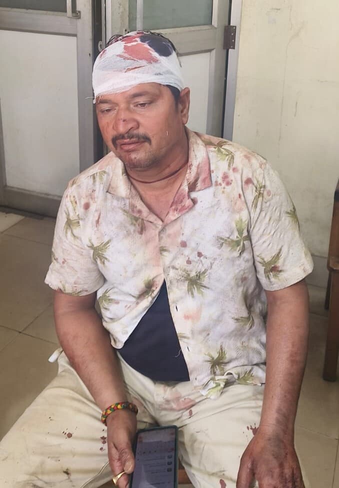 Bokaro News : भाजयुमो नेता से मारपीट, लोगों ने करायी दुकानें बंद