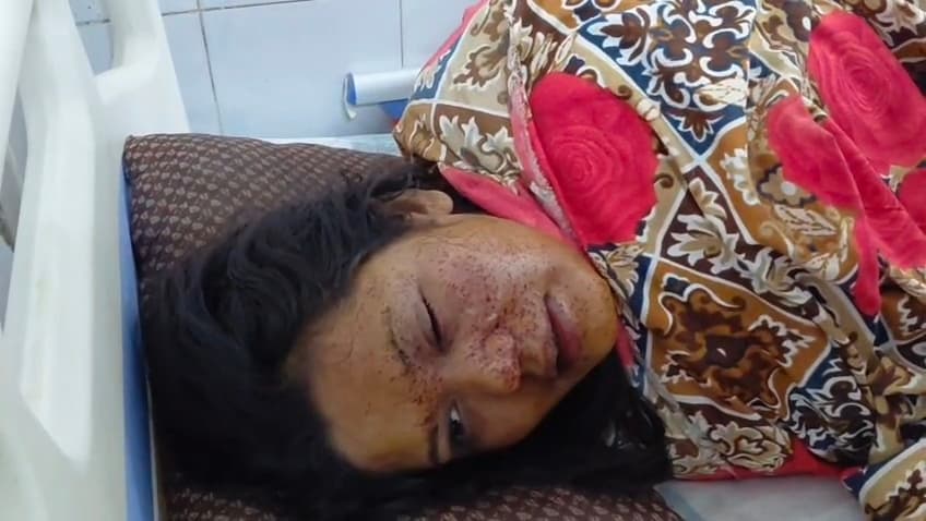 रिसेप्शन में गूंजा फायर, आर्केस्ट्रा की महिला कलाकार हुई घायल