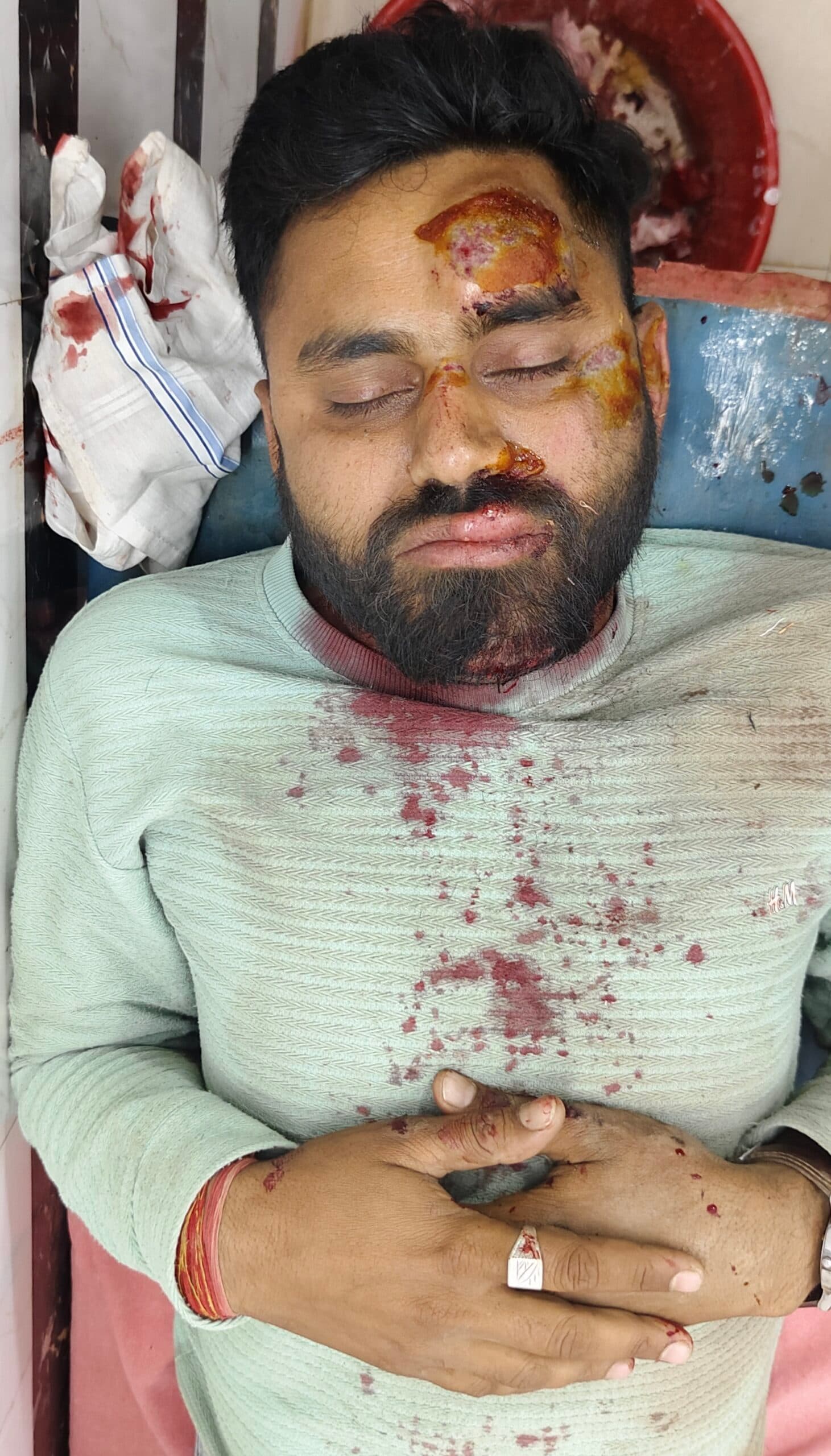 सड़क दुर्घटना में बाइक सवार युवक गंभीर रूप से घायल