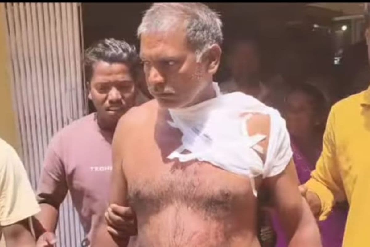 गढ़वा में बेखौफ अपराधी: ग्राहक बनकर आए युवक ने दुकानदार को मार दी गोली, हालत गंभीर