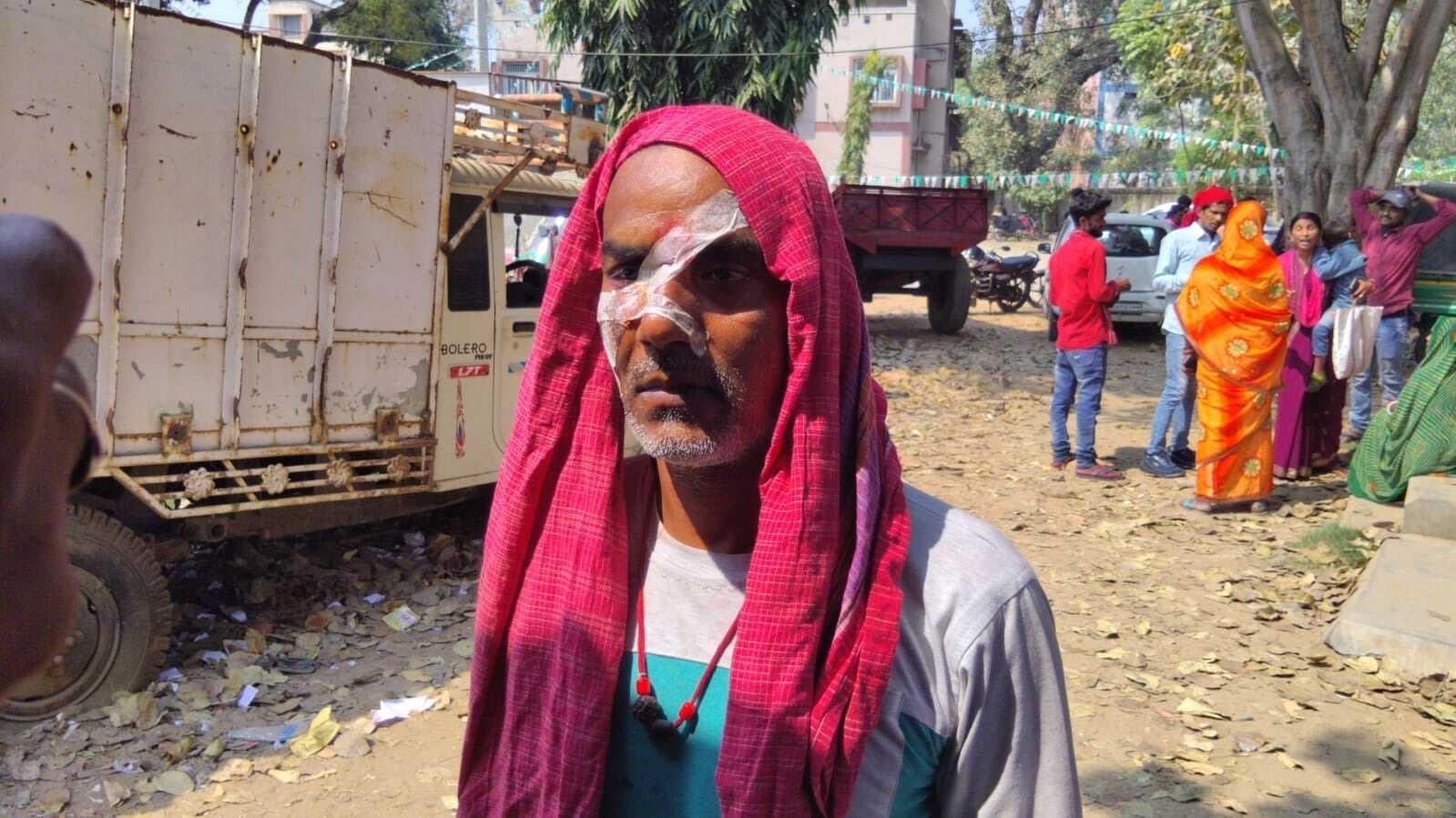 बच्चों के बीच विवाद में अधेड़ को पीटकर किया जख्मी