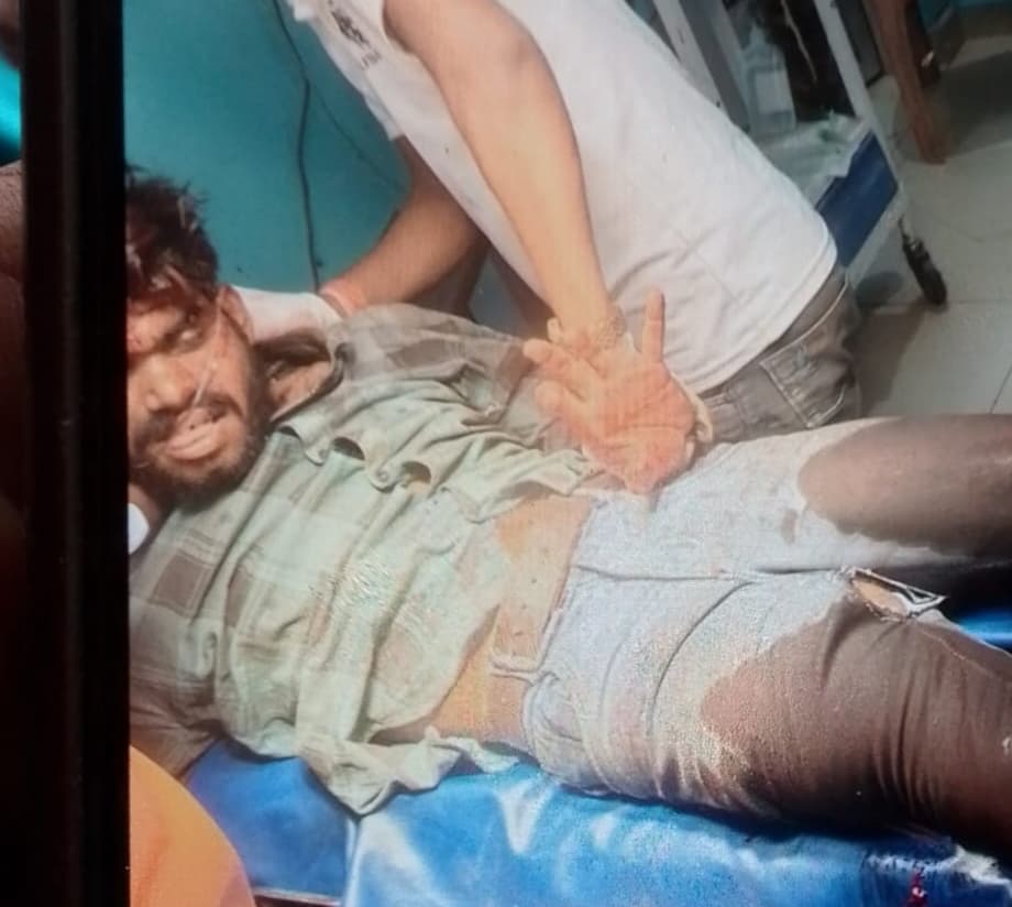 बाइक से हुई दुर्घटना में कट गया युवक का पैर