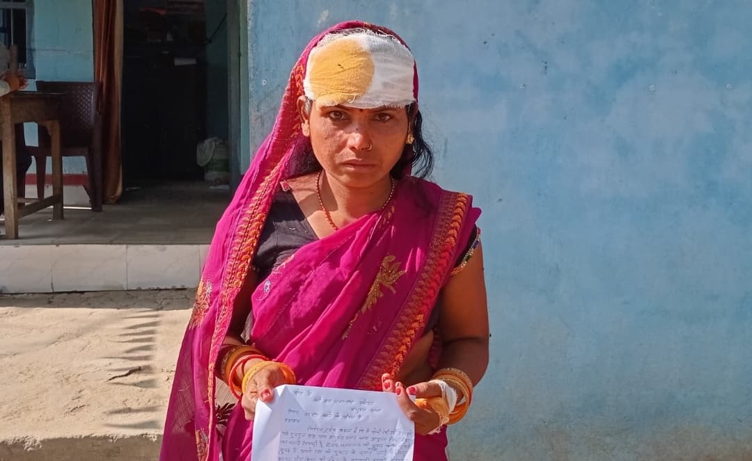 घरेलू विवाद में महिला को मारपीट कर किया जख्मी