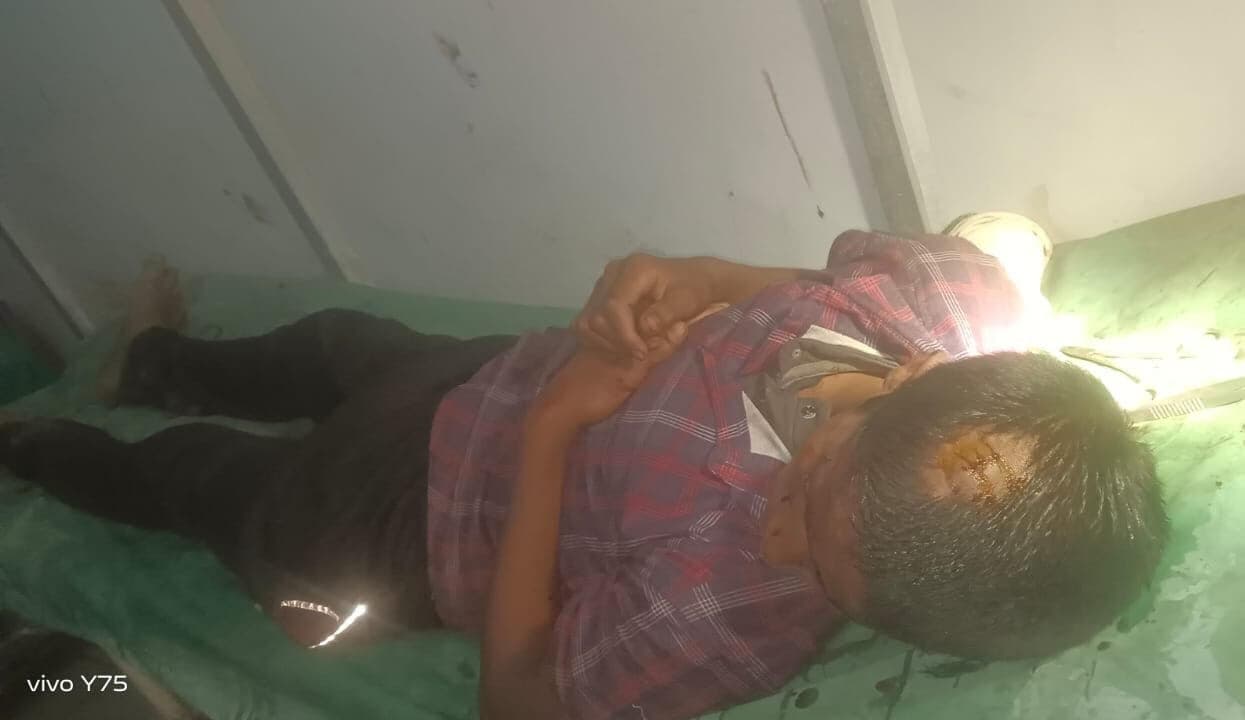 मारपीट में दो लोग घायल, चल रहा इलाज