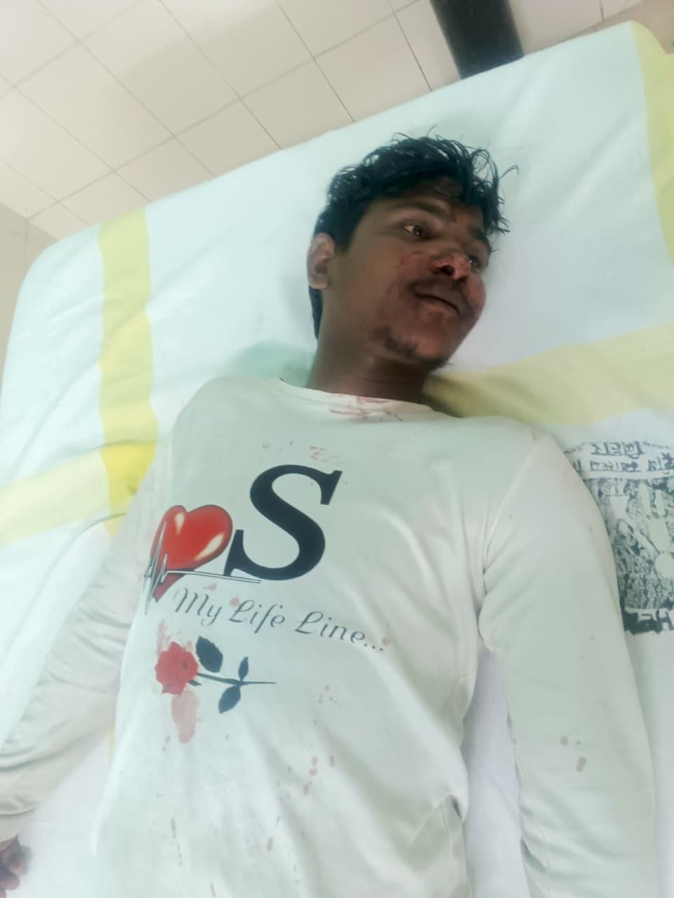 जुआ के पैसे को लेकर मारपीट, बीच-बचाव करने गए युवक को बेरहमी से पीटा