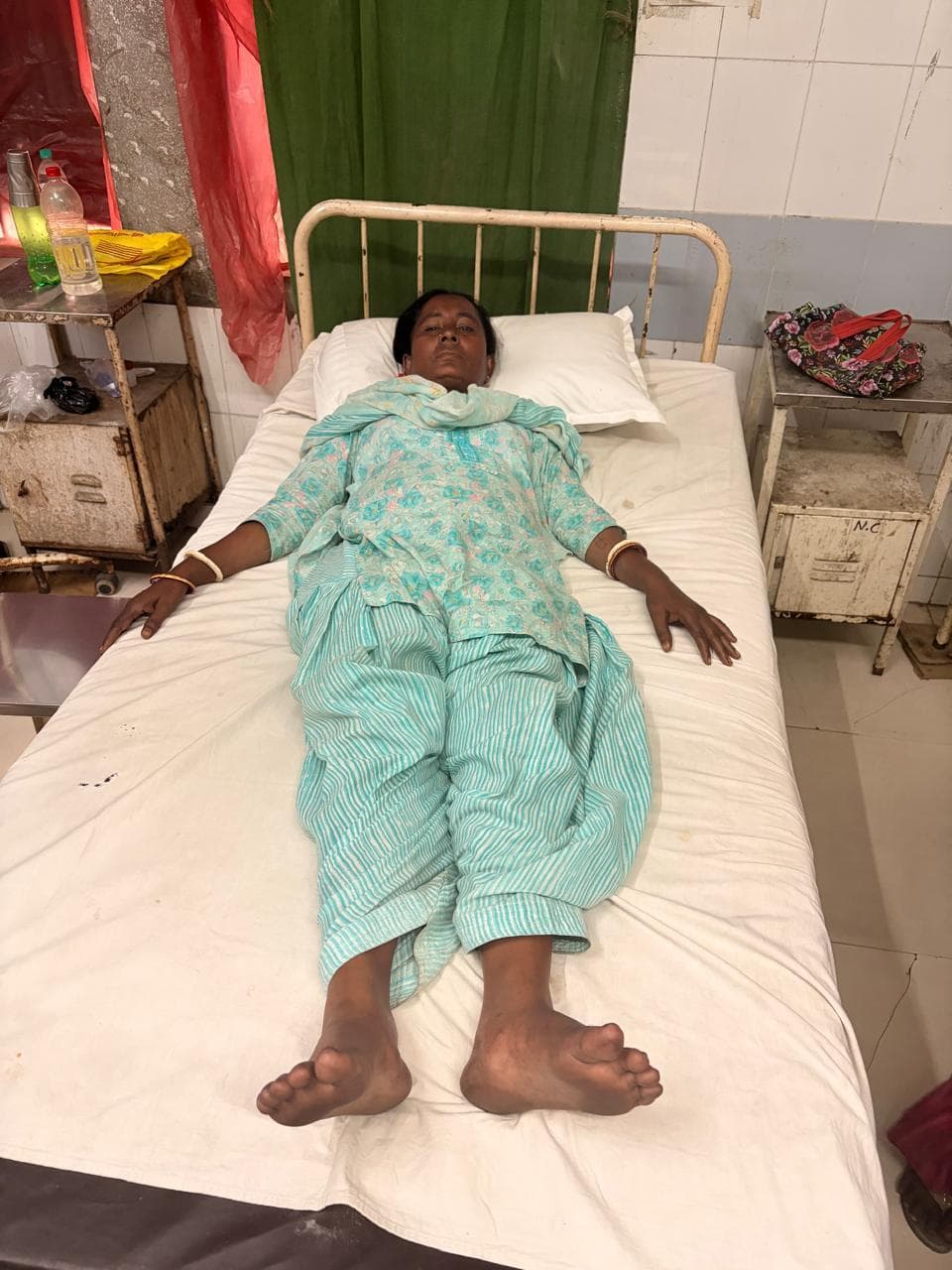 Dhanbad News: कोयला चोरों ने महिला गार्ड पर किया हमला, पैर टूटा, मजदूरों ने उत्पादन ठप कराया