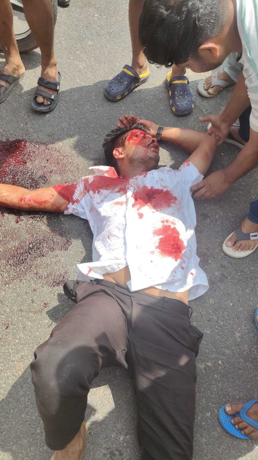 दो बाइकों की टक्कर में महिला समेत छह लोग जख्मी