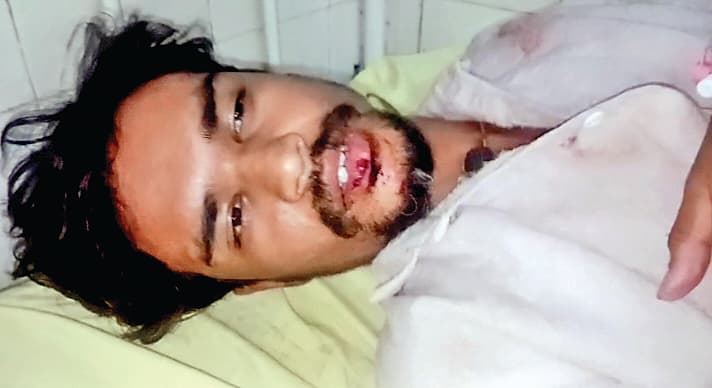 दुर्गापुर में तृणमूल कार्यकर्ता की पिटाई