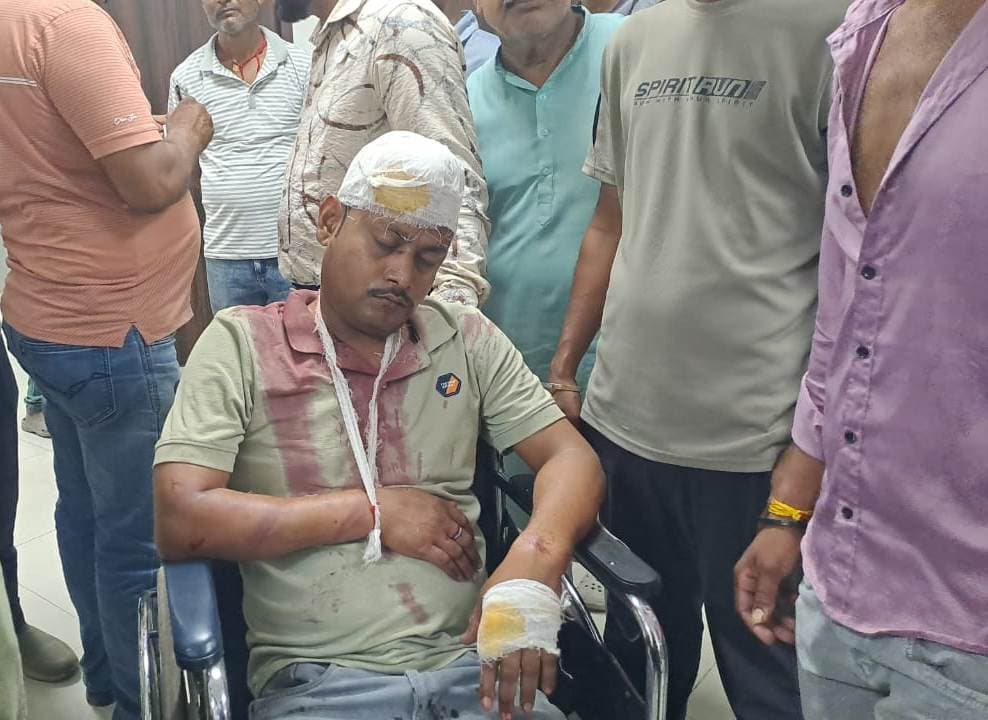 निगम के चालक की बेरहमी से पिटाई, हायर सेंटर रेफर