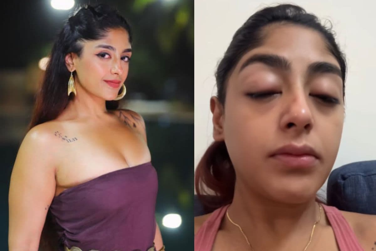 मुंबई के क्लब में सरेआम पिटीं MTV Splitsvilla X6 फेम प्रीत सिंह, सूजा हुआ चेहरा और टूटा दांत लेकर बयां किया अपना दर्द, VIDEO