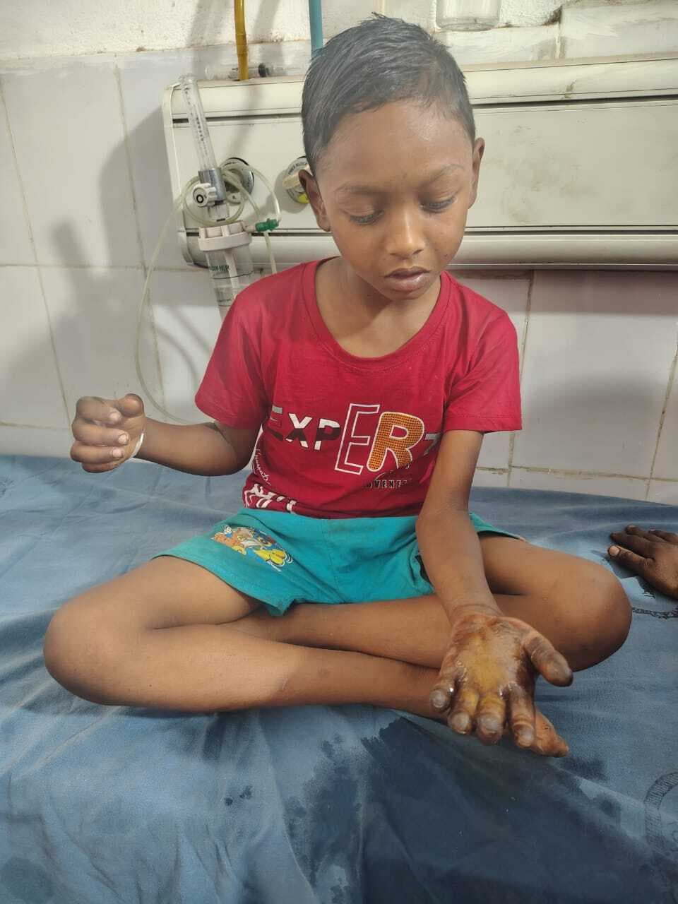 पड़ोसी के घर खेलने गया बच्चा बम धमाके में घायल, दो गिरफ्तार