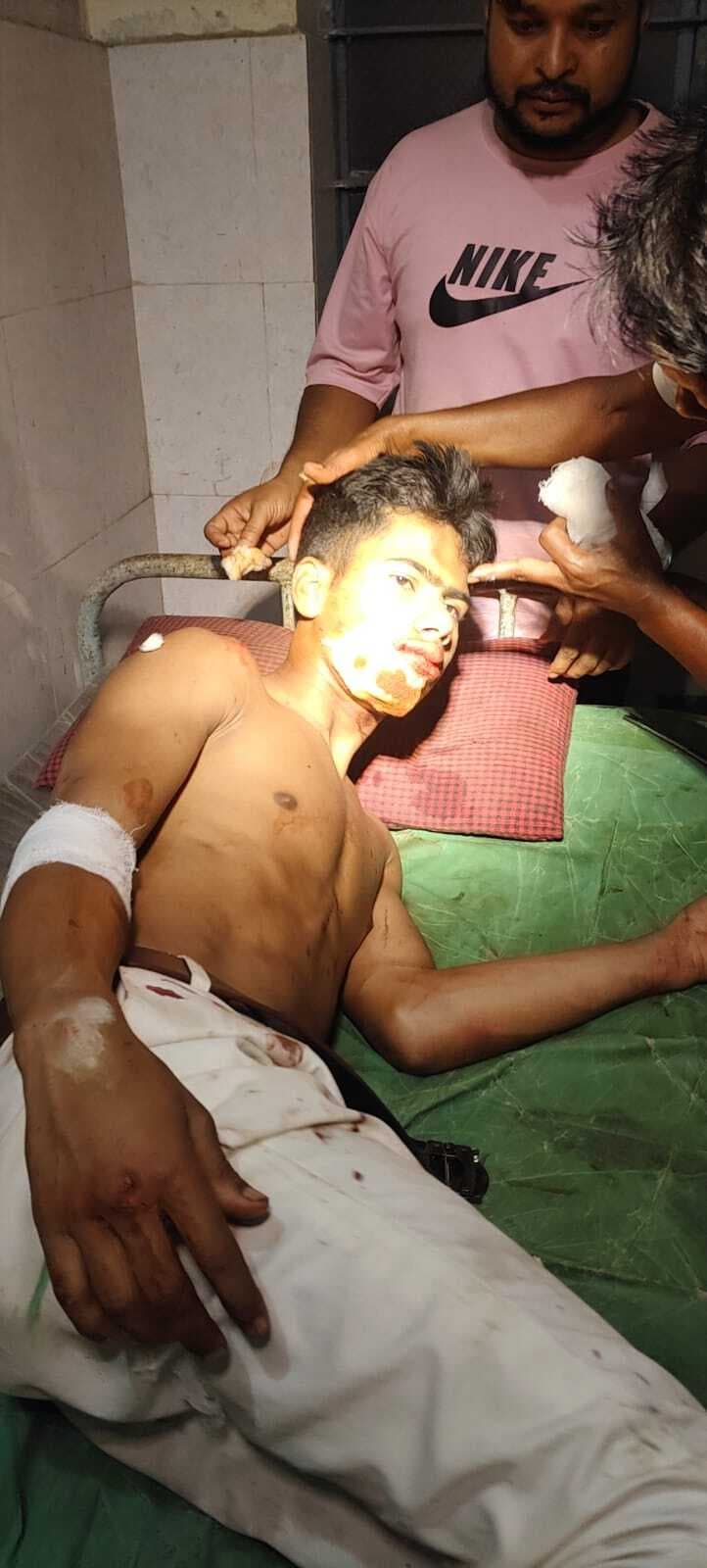 Chaibasa News : कार चालक ने दो नाबालिग को रौंदा भागने के दौरान ग्रामीणों ने दबोचा