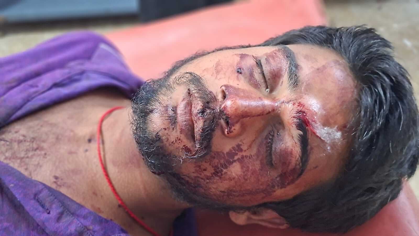 जनरल स्टोर दुकान पर मारपीट व लूटपाट, प्राथमिकी दर्ज