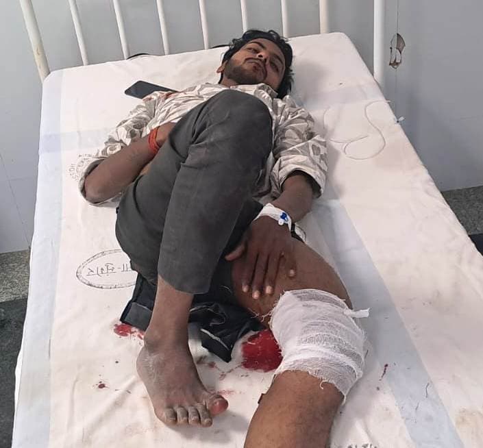 सीखने के दौरान खड़ी ट्रक से टकरायी बाइक, गर्लफ्रेंड व युवक घायल