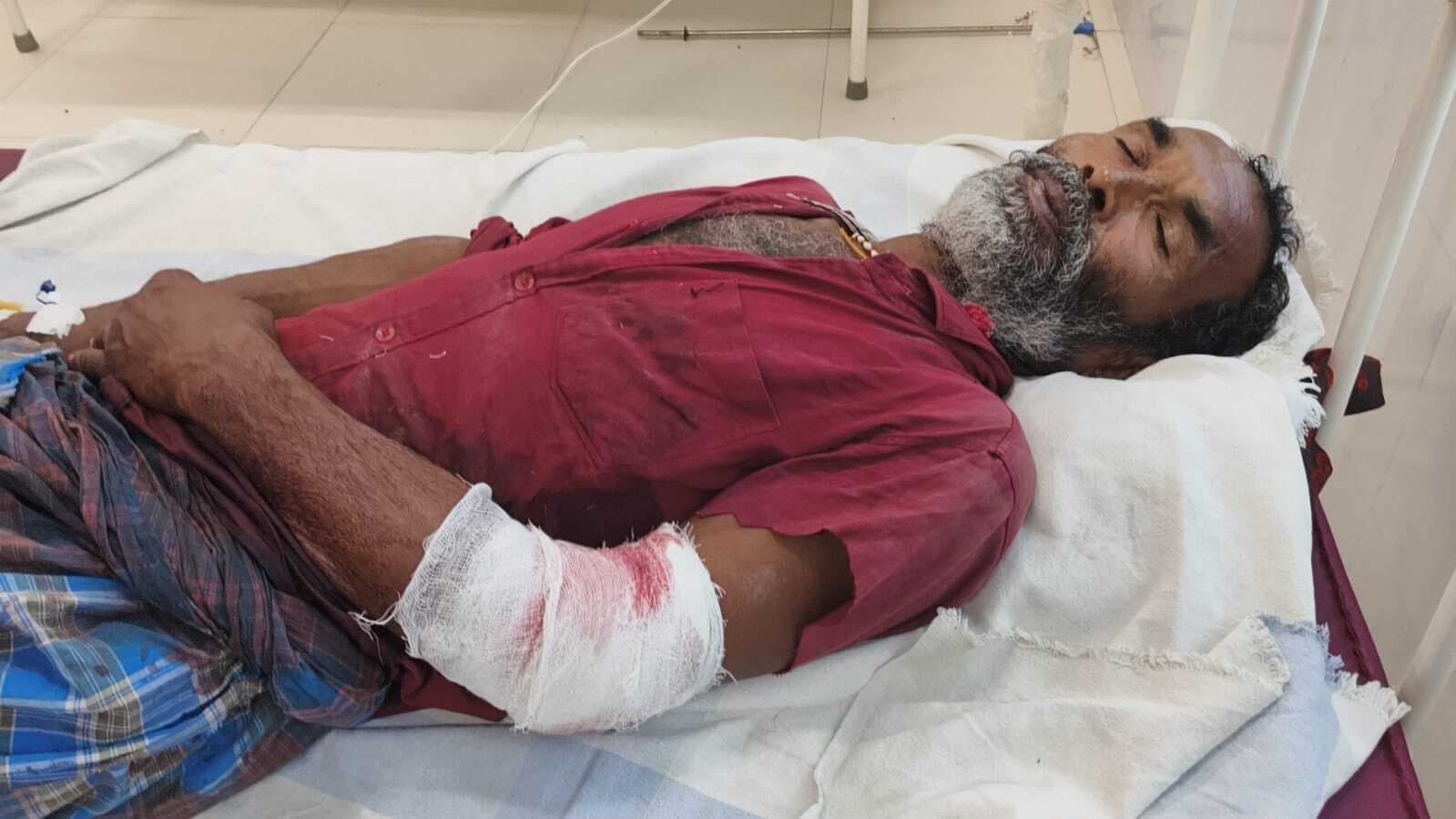 सो रहे किसान को अपराधियों ने मारी गोली, हायर सेंटर रेफर