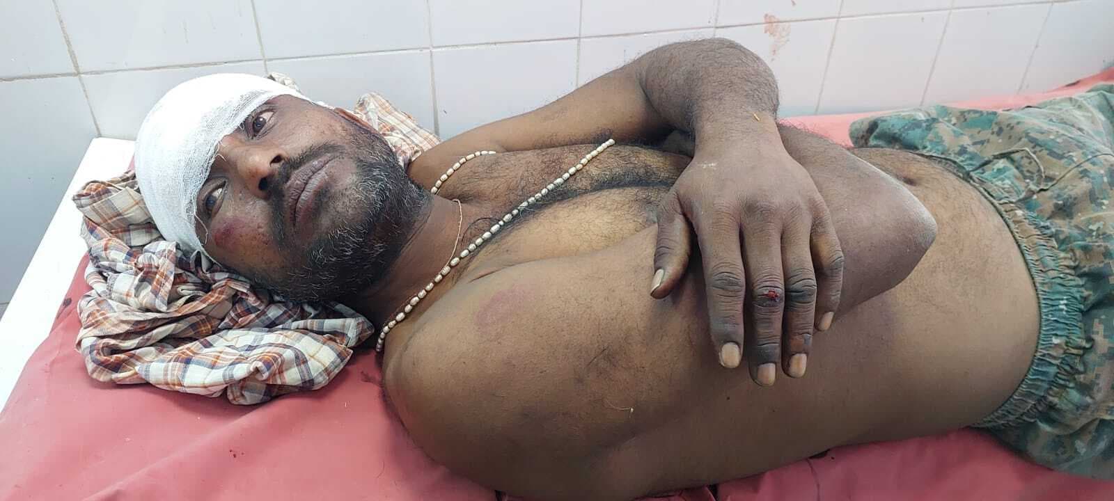 किऊल थाना क्षेत्र के सिंहचक गांव में जमीन विवाद में दो पक्षों में जमकर हुई मारपीट