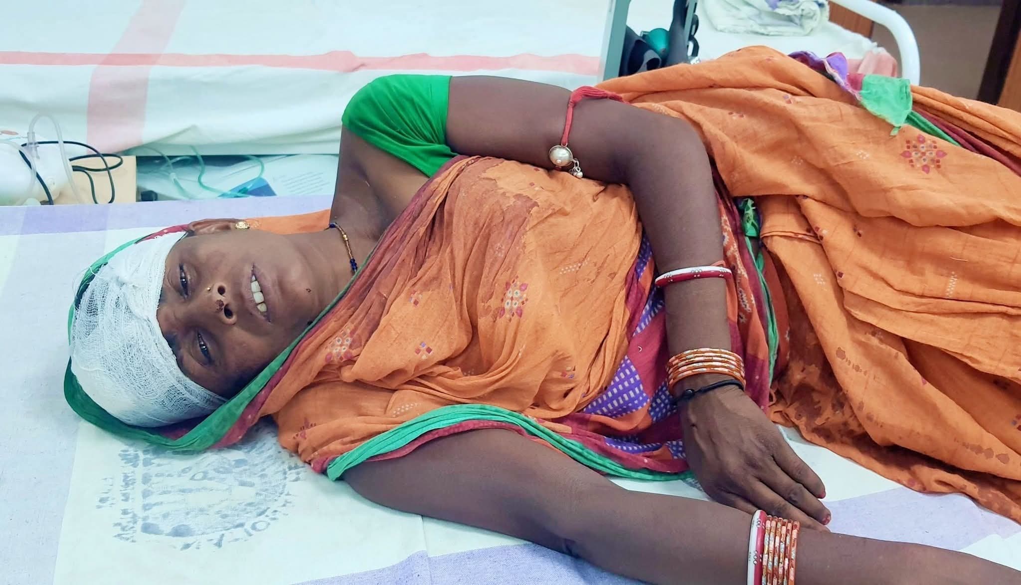 भैंसुर ने डंडे से सिर पर प्रहार कर महिला को किया घायल