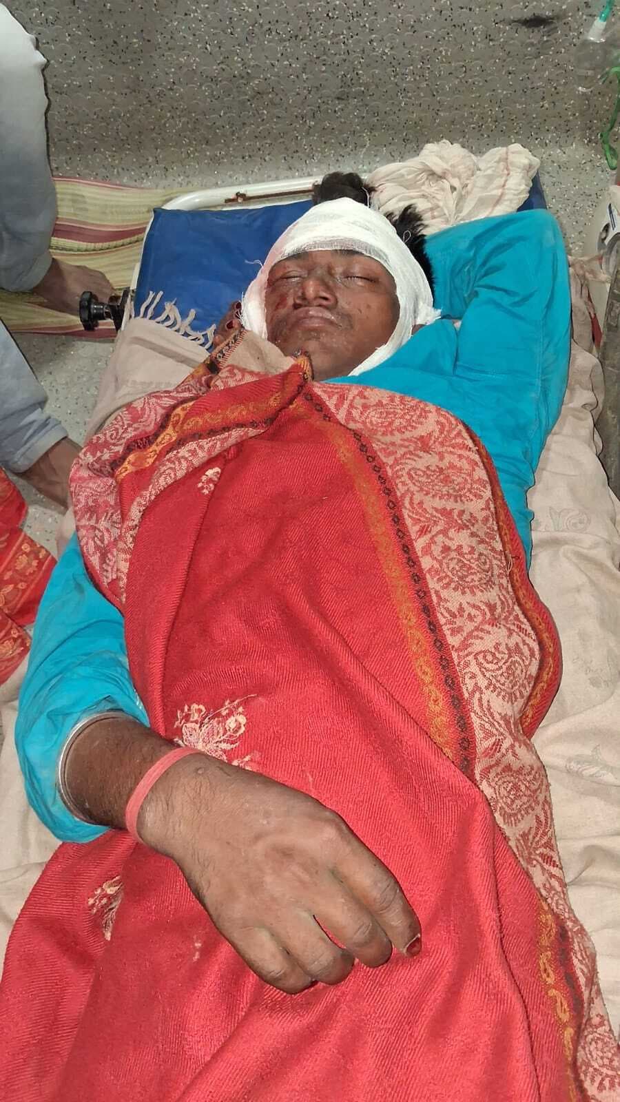 निर्माणाधीन पुल के समीप गड्ढे में गिरा बाइक सवार, जख्मी