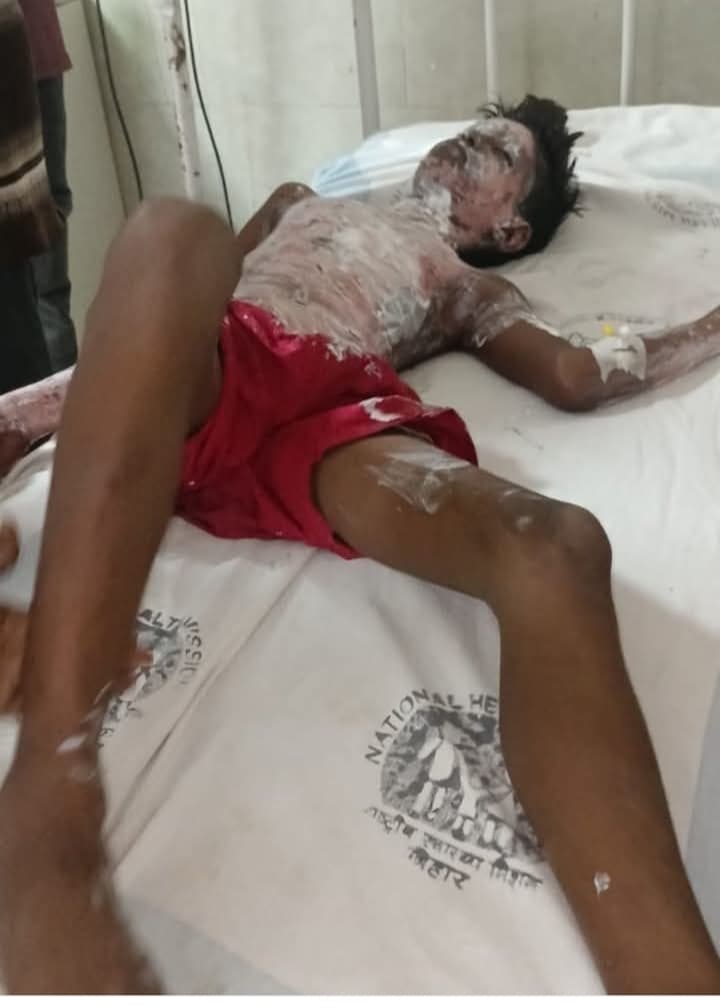 करेंट की चपेट में आने से किशोर झुलसा