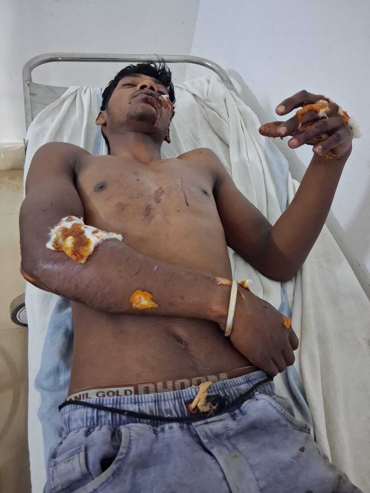 तेज रफ्तार स्कूटी की टक्कर से युवक घायल