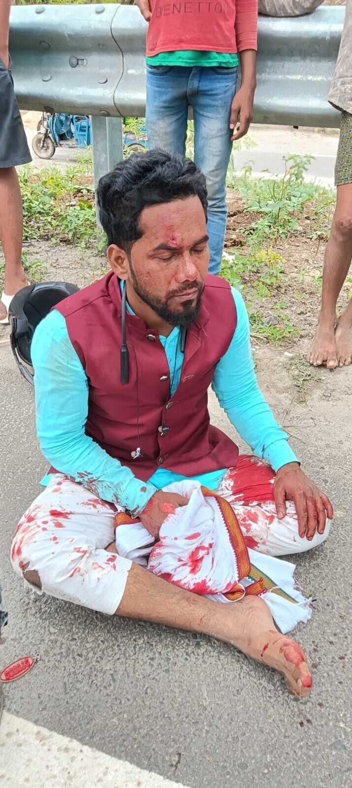 स्कॉर्पियो चालक ने बाइक सवार को मारी जोरदार टक्कर, गंभीर रूप से घायल