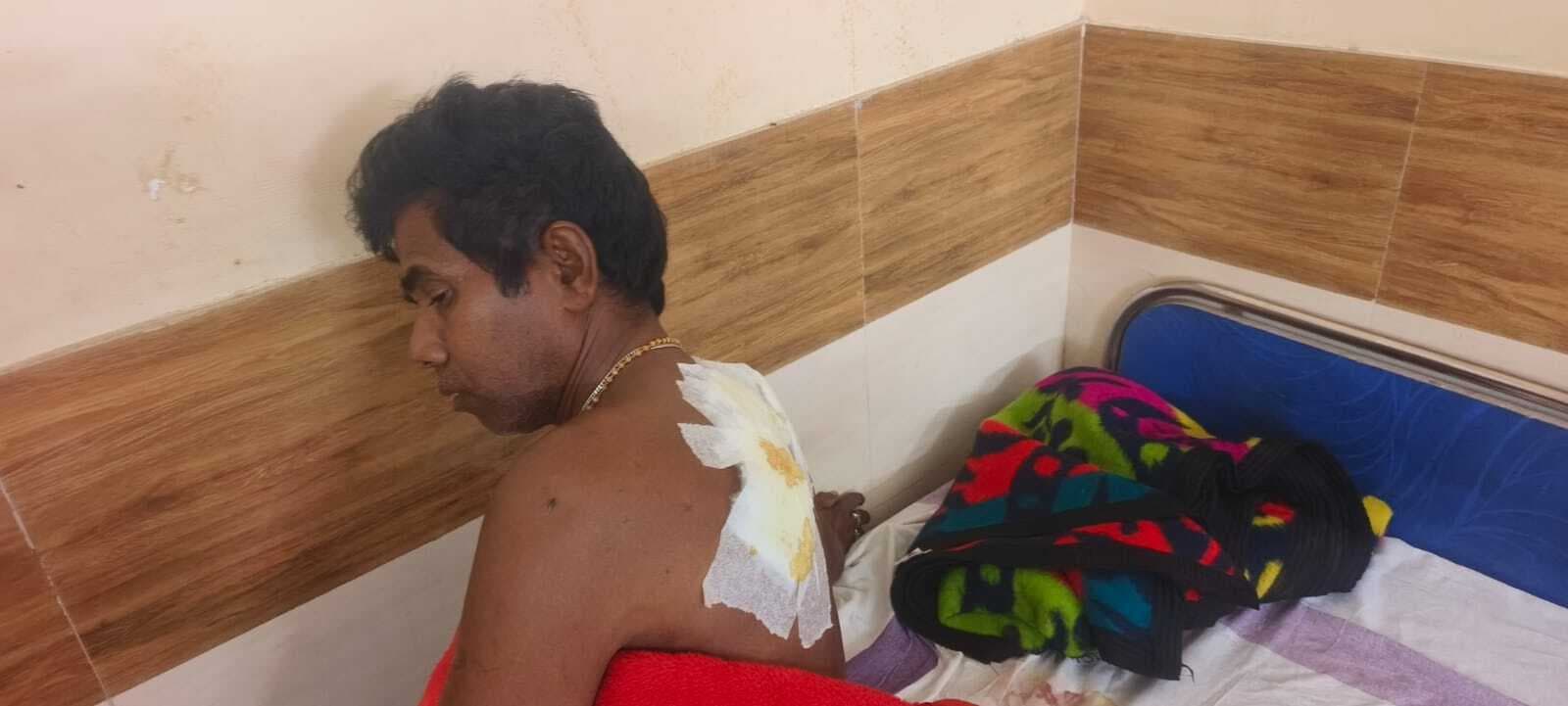 Kishanganj धारदार हथियार से हमला कर चोर फरार, गृहस्वामी घायल