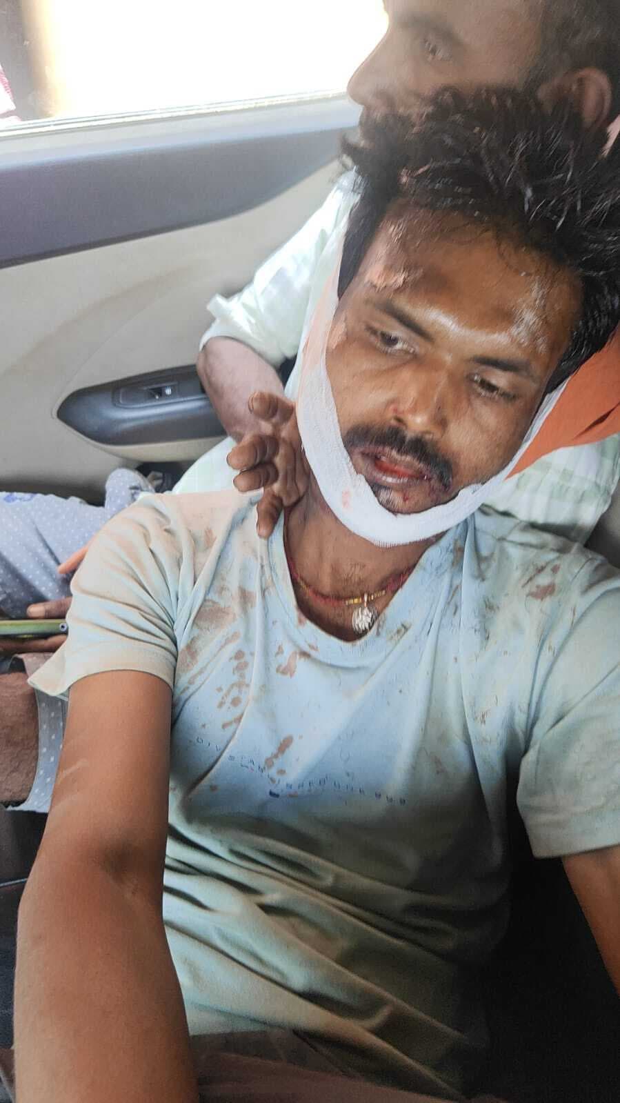 Saharsa News : हाईटेंशन तार की चपेट में आने से व्यक्ति झुलसा, हालत गंभीर