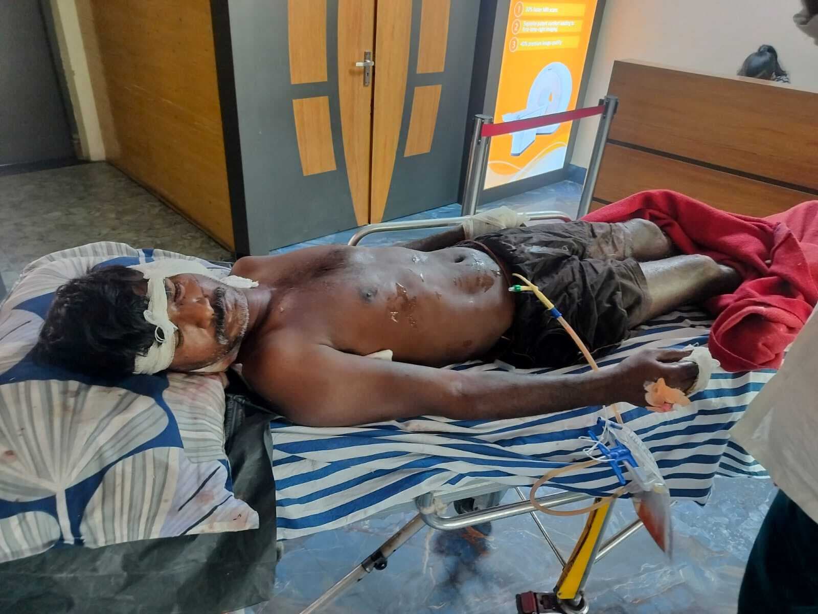 Aurangabad News : पुरानी रंजिश में पूर्व मुखिया के भाई पर जानलेवा हमला