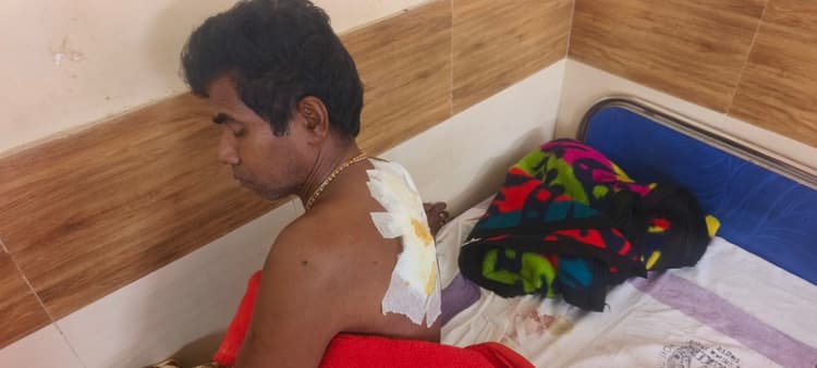 चोरी का विरोध करने पर गृहस्वामी को चाकू मारकर किया घायल