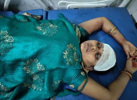 मोटरसाइकिल अनियंत्रित होकर सड़क पर गिरी, दंपती घायल