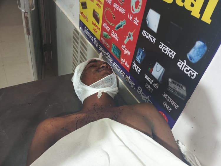 JAMUI गिद्धौर रेलवे स्टेशन पर ट्रेन से गिरा युवक हालत गंभीर