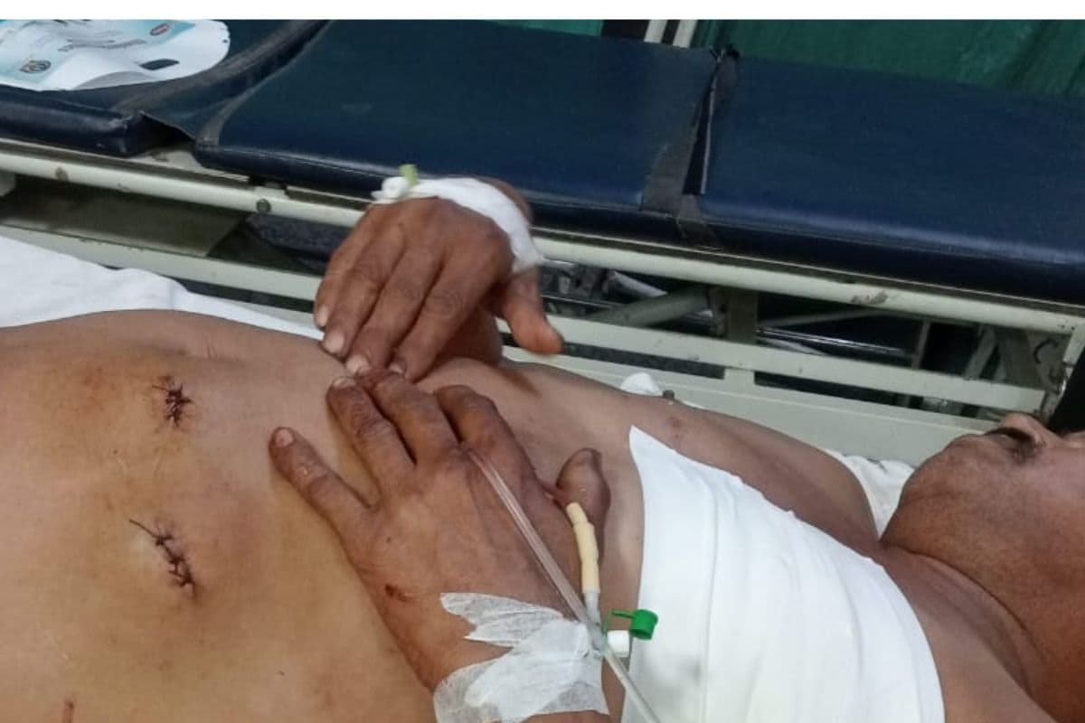 Gopalganj News: मांझा बाजार में पूर्व आर्मी जवान पर जानलेवा हमला