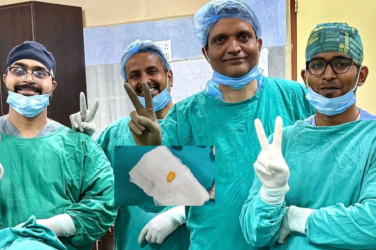 IGIMS में 4 वर्षीय बच्चे की सांस की नली से निकाला गया मक्के का दाना