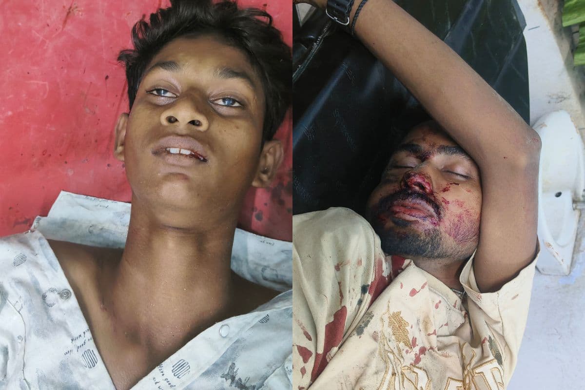 अमौर में स्टेट हाईवे-99 पर दो बाइकों की आमने-सामने भीषण भिड़ंत; दो युवक गंभीर रूप से घायल, पूर्णिया रेफर