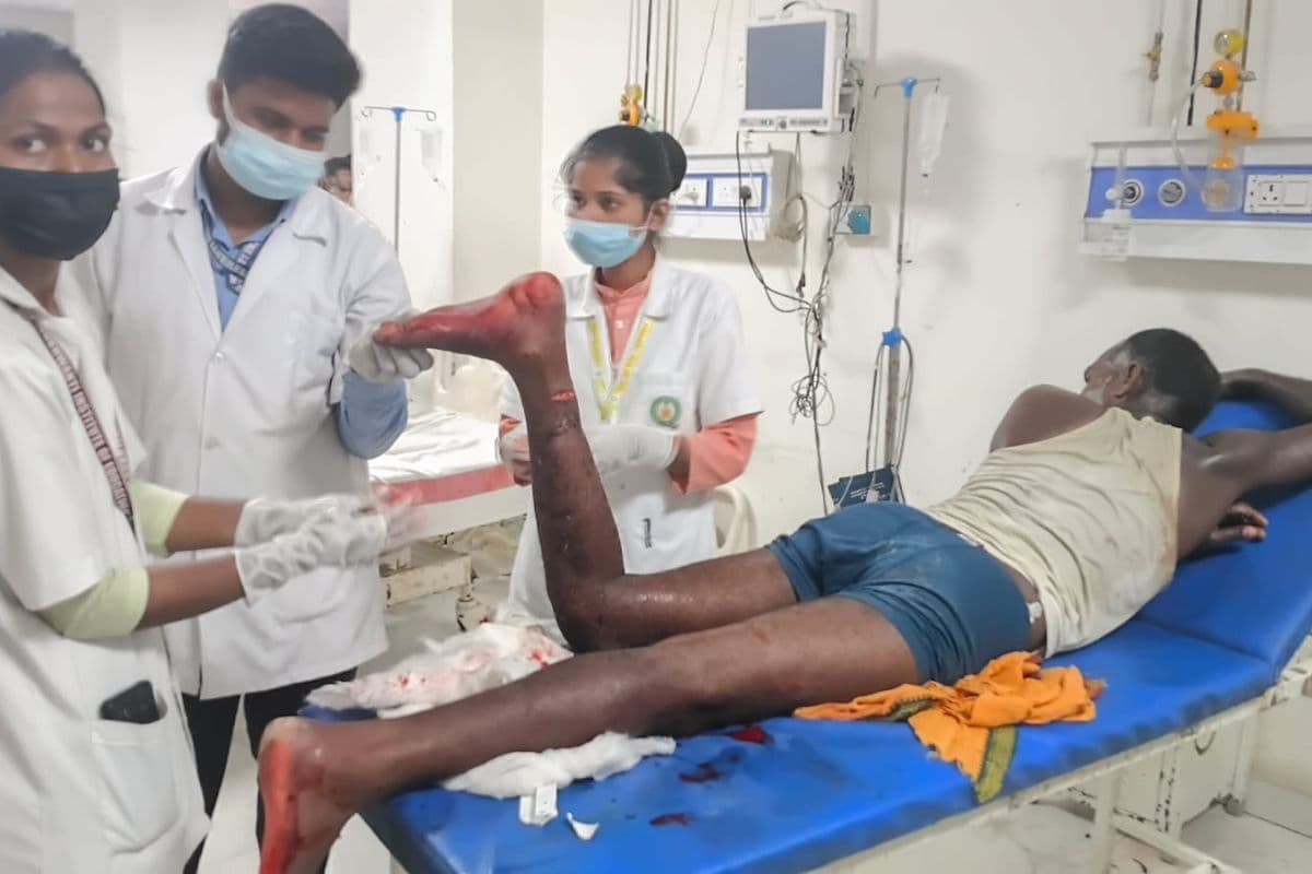 Siwan News : मकान निर्माण के दौरान बंदर ने मजदूर पर बोला हमला, अस्पताल में भर्ती