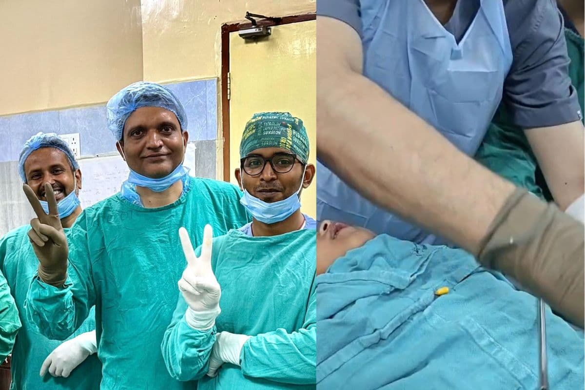 पटना के IGIMS में 4 साल के बच्चे की जान बची, सांस की नली से सफलतापूर्वक निकाला गया मक्के का दाना